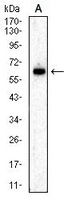 1 - Anti-Perforin 1 Antibody AP96015
