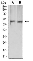 1 - Anti-AMPK alpha 2 Antibody AP96016
