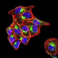 3 - Anti-Prosaposin Antibody AP96017