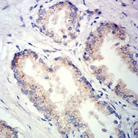 19 - Anti-Prosaposin Antibody AP96017