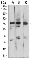 1 - Anti-Prosaposin Antibody AP96017