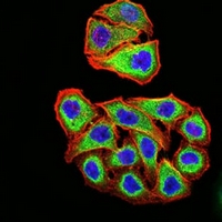 3 - Anti-PSMC3 Antibody AP96018