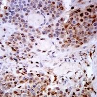19 - Anti-PSMC3 Antibody AP96018