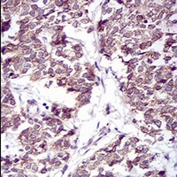 19 - Anti-PTP1B Antibody AP96019