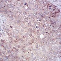 19 - Anti-RAB11FIP1 Antibody AP96021