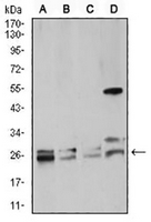 1 - Anti-RAB5A Antibody AP96023