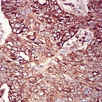 19 - Anti-RAB6B Antibody AP96024