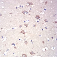 19 - Anti-RAD21 Antibody AP96025