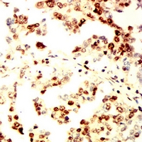 19 - Anti-RAD23B Antibody AP96026