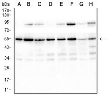 1 - Anti-RAD23B Antibody AP96026
