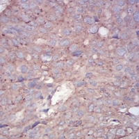 19 - Anti-RALA Antibody AP96030