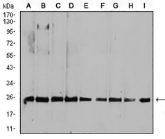1 - Anti-RALA Antibody AP96030