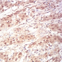19 - Anti-RAN Antibody AP96032