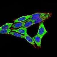 3 - Anti-RB1 Antibody AP96034