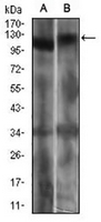 1 - Anti-RB1 Antibody AP96034