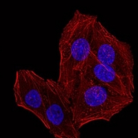 3 - Anti-RbAp46 Antibody AP96035