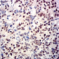 19 - Anti-RbAp46 Antibody AP96035