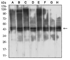 1 - Anti-RbAp46 Antibody AP96035
