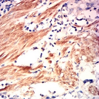19 - Anti-RhoA Antibody AP96037