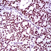 19 - Anti-RING1 Antibody AP96038