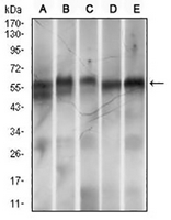 1 - Anti-RING1 Antibody AP96038