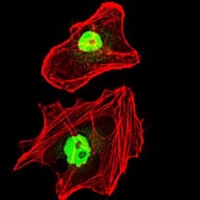 3 - Anti-RPA1 Antibody AP96039