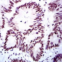 19 - Anti-RPA1 Antibody AP96039
