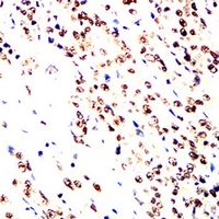 19 - Anti-RPA2 Antibody AP96040