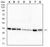 1 - Anti-RPA2 Antibody AP96040
