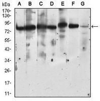 1 - Anti-RSK3 Antibody AP96041