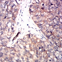 19 - Anti-RRM1 Antibody AP96042