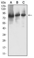 1 - Anti-RRM1 Antibody AP96042