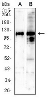 1 - Anti-SALL4 Antibody AP96043