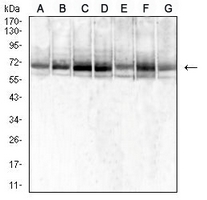 1 - Anti-SDHA Antibody AP96046