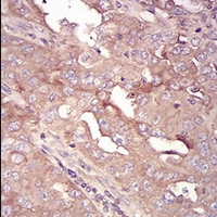 19 - Anti-Serpin A3 Antibody AP96047