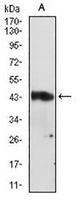 1 - Anti-Serpin A3 Antibody AP96047