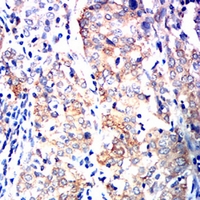 19 - Anti-Siglec 15 Antibody AP96051