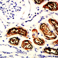 19 - Anti-SLC22A12 Antibody AP96055