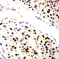 19 - Anti-SLC7A3 Antibody AP96057