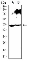 1 - Anti-SLC7A3 Antibody AP96057