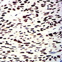 19 - Anti-SNF2L Antibody AP96058