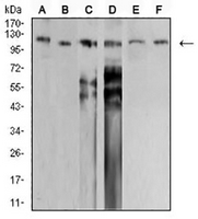 1 - Anti-SNF2L Antibody AP96058