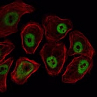 3 - Anti-SMC1A Antibody AP96059