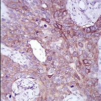 19 - Anti-SLUG Antibody AP96060
