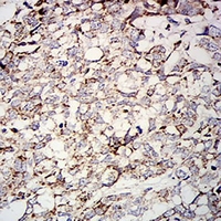 19 - Anti-SOD2 Antibody AP96061