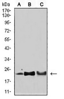 1 - Anti-SOD2 Antibody AP96061