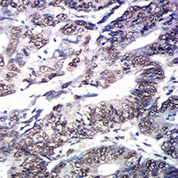 19 - Anti-SOX11 Antibody AP96062