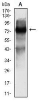 1 - Anti-SOX11 Antibody AP96062