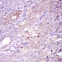 19 - Anti-p62 Antibody AP96064