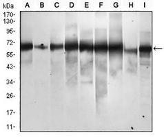 1 - Anti-p62 Antibody AP96064